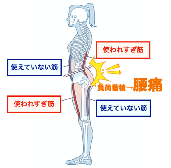 tre02 使われすぎな筋と使えていない筋のイラスト